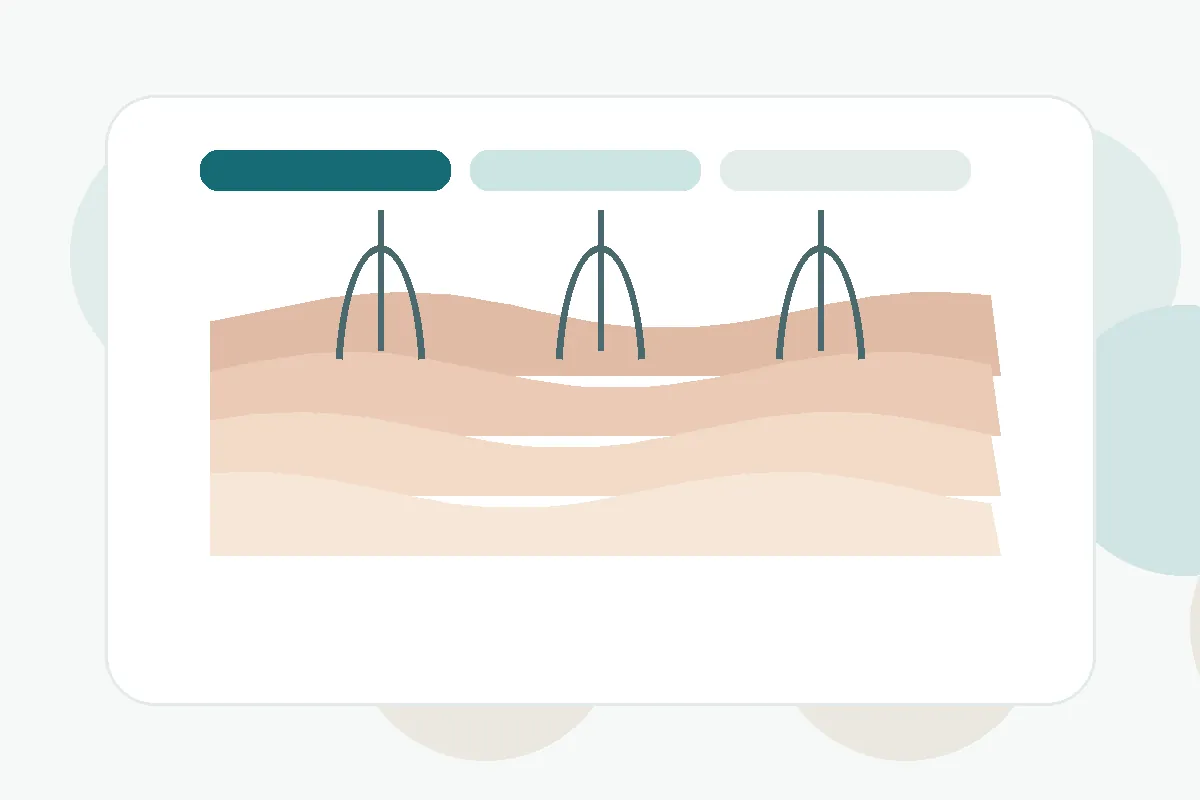 Ilustración educativa sobre cuidado dermatológico y estructura de la piel